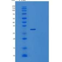 人UTP23重组蛋白