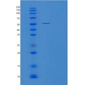 人酪氨酰tRNA合成酶2(YARS2)重组蛋白