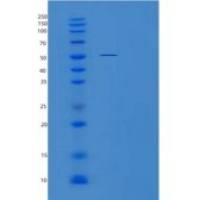 人酪氨酰tRNA合成酶2(YARS2)重组蛋白