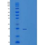 人酶原粒蛋白16同源物B(ZG16B)重组蛋白