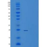 人酶原粒蛋白16同源物B(ZG16B)重组蛋白