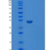 人A组着色性干皮病偶联因子(XPA)重组蛋白
