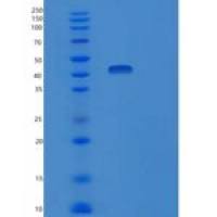 人泛素结合酶E2 D4重组蛋白