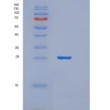 人AN1-型锌指域蛋白5(ZFAND5)重组蛋白