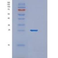 人AN1-型锌指域蛋白5(ZFAND5)重组蛋白