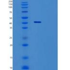 人细胞毒性T淋巴细胞蛋白4/CTLA-4/CD152(C-Fc)重组蛋白