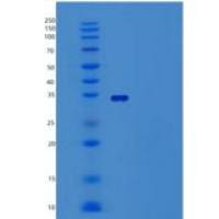 人生长激素释放因子/GHRF/生长激素释放肽(C-Fc)重组蛋白