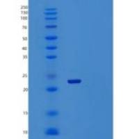 人肝配蛋白-B2/EFNB2(C-6His)重组蛋白