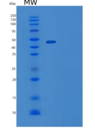 人YY1转录因子(YY1)重组蛋白