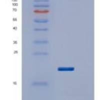 人视网膜血管瘤肿瘤抑制因子(vHL)重组蛋白