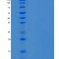 小鼠Epidermal Growth Factor/EGF(C-6His)重组蛋白