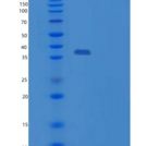 人Y-框结合蛋白1(YBX1)重组蛋白