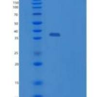 人Y-框结合蛋白1(YBX1)重组蛋白
