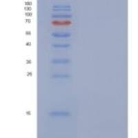 人WAP四二硫化物核心域蛋白12(WFDC12)重组蛋白