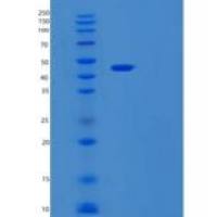 人泛醌细胞色素C还原酶核心蛋白Ⅱ(UQCRC2)重组蛋白