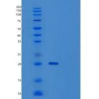 人泛素表达转录因子(UXT)重组蛋白