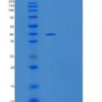 小鼠核心蛋白聚糖/前列腺素S2/前列腺素40(C-6His)重组蛋白