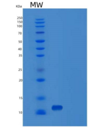 小鼠囊泡关联膜蛋白2(VAMP2)重组蛋白