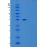 大鼠IgG2A Fc/Igg-2a重组蛋白