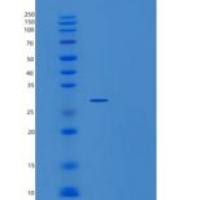 人ZC4H2重组蛋白