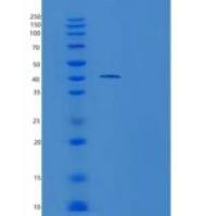 人泛素特异性肽酶46(USP46)重组蛋白