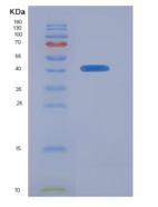 人ZW10交互子(ZWINT)重组蛋白