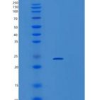 小鼠VPS29重组蛋白