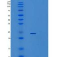 小鼠VPS29重组蛋白