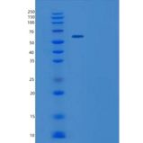 人WHSC2重组蛋白