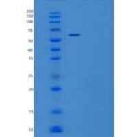 人WHSC2重组蛋白