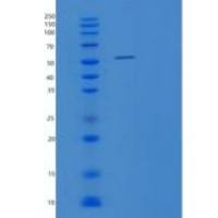 人酪氨酰tRNA合成酶(YRS (Tyrosyl-tRNA synthetase)重组蛋白
