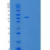 人尿卟啉原脱羧酶(UROD)重组蛋白