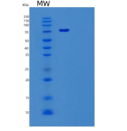 人血管细胞粘附分子1(VCAM1)重组蛋白