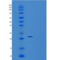 人VPS25重组蛋白