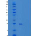 人ZNHIT1重组蛋白