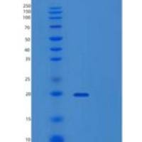 人ZNHIT1重组蛋白