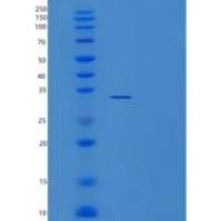 人ZNF32重组蛋白