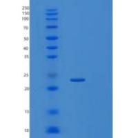 人整合膜蛋白2B/ITM2B/imBRI2(C-6His)重组蛋白