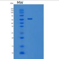 人液泡蛋白分选相关蛋白4B（VPS4B）重组蛋白