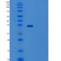 人锌α-2糖（Zinc-alpha-2-glyco）重组蛋白