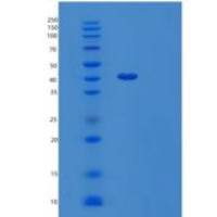 人液泡蛋白分选相关蛋白26A（VPS26A）重组蛋白