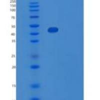 人ZCCHC12重组蛋白