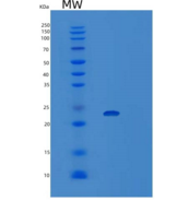 人VPS29 1-182aa重组蛋白