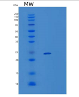 人VPS28重组蛋白