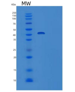 小鼠t细胞特异性表面糖蛋白CD28重组蛋白