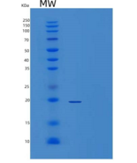 人酶原粒蛋白16同源物B(ZG16B)重组蛋白