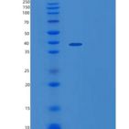 人ZADH2重组蛋白