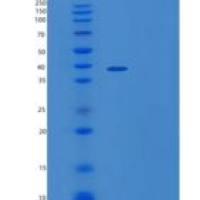 人ZADH2重组蛋白