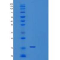 人含锌飘带域蛋白1(ZNRD1)重组蛋白