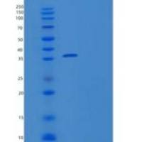 人无翅型MMTV整合位点家族成员3A(WNT3A)重组蛋白